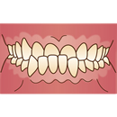 悪い歯並び　下顎前突